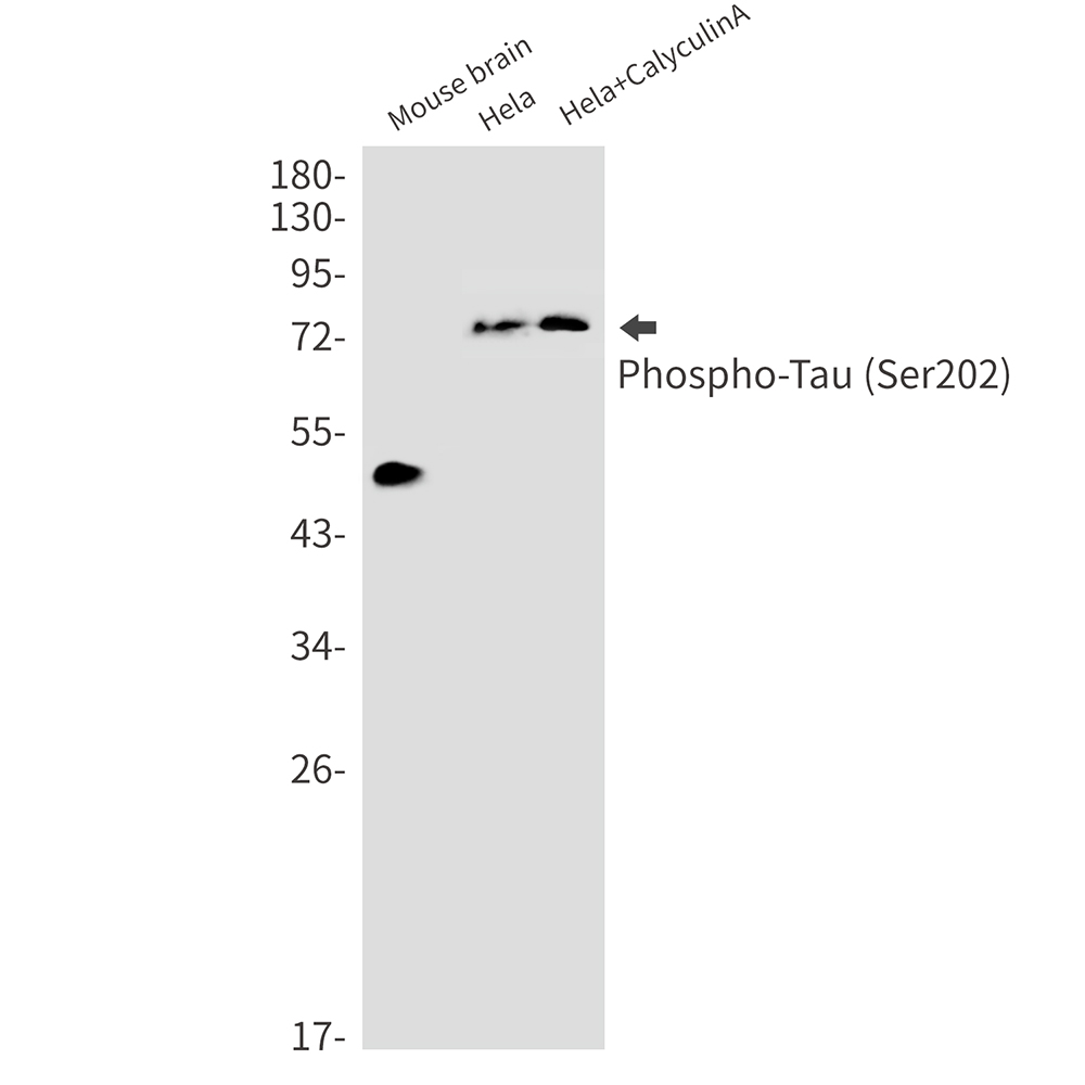 Phospho-Tau (Ser202)