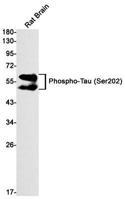 Rabbit Monoclonal Antibody to Phospho-Tau (Ser202)