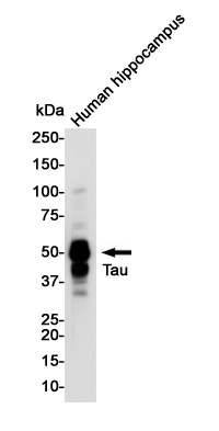 Phospho-Tau (Thr50)