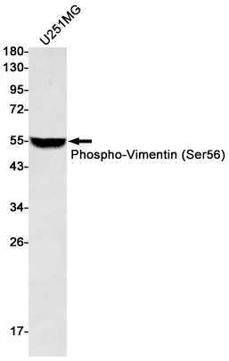 Phospho-Vimentin (Ser56)