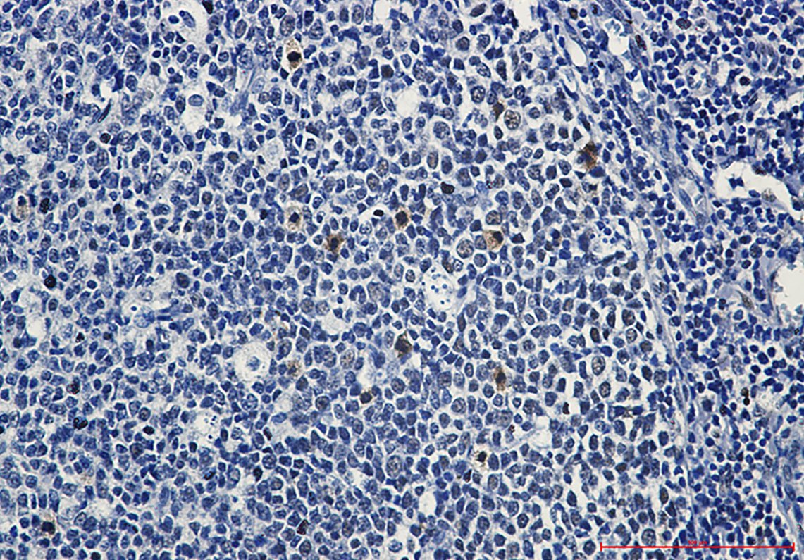 Rabbit Monoclonal Antibody to Phospho-c Myb (Ser11)