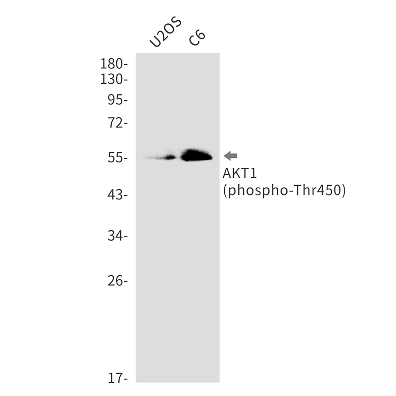 Phospho-AKT1 (Thr450)