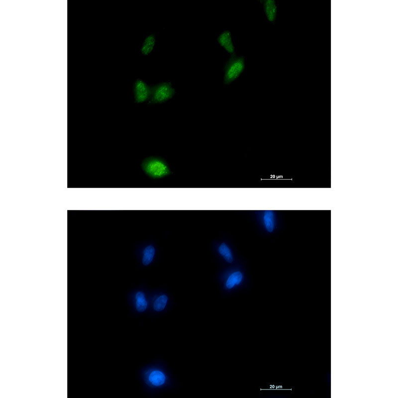 Rabbit Monoclonal Antibody to Phospho-Amyloid Precursor Protein (Thr743)