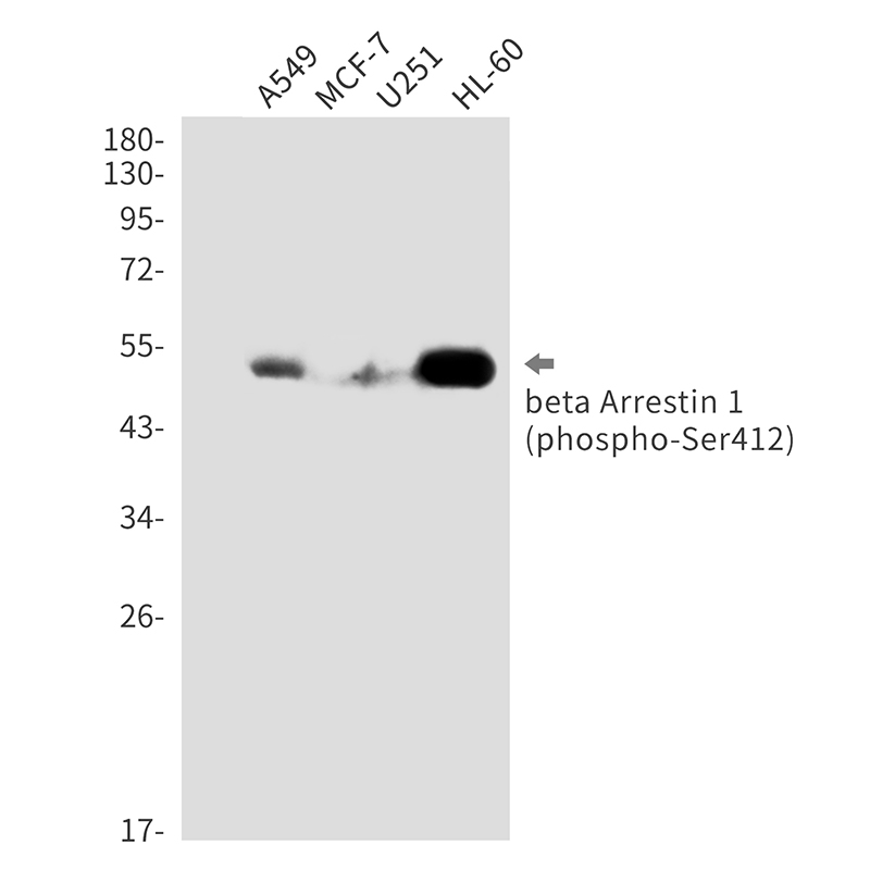 Phospho-beta Arrestin 1 (Ser412)