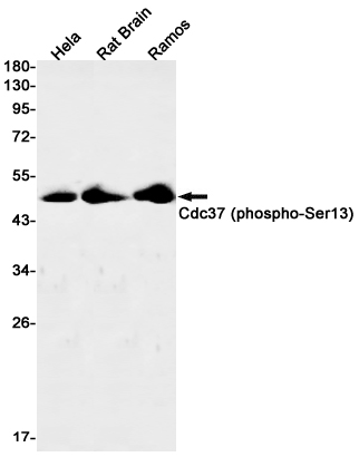 Rabbit Monoclonal Antibody to Phospho-CDC37 (Ser13)