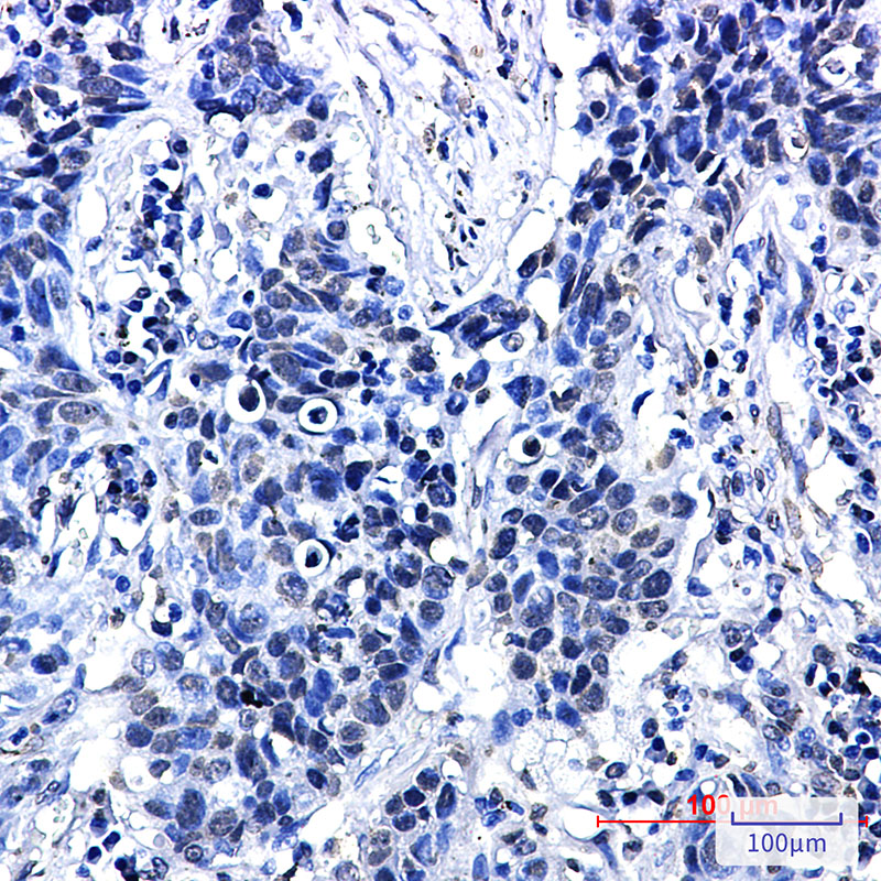Rabbit Monoclonal Antibody to Phospho-delta 1 Catenin (Thr916)