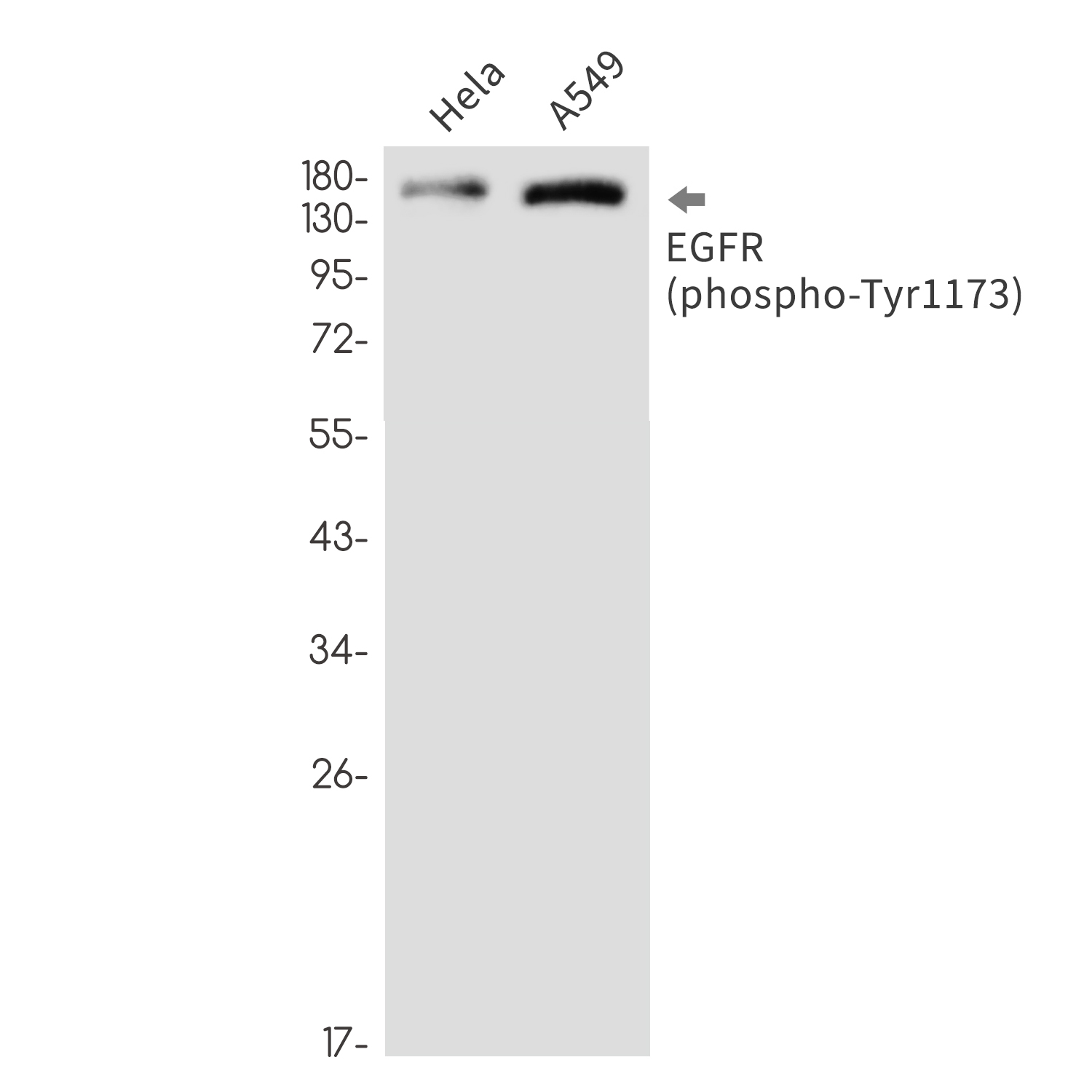 Phospho-EGFR (Tyr1173)