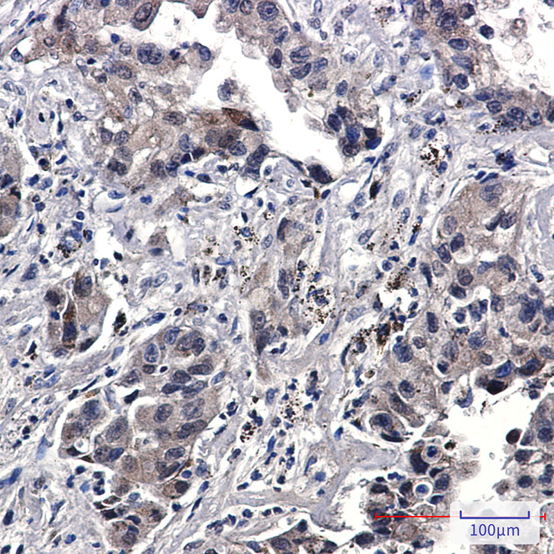 Rabbit Monoclonal Antibody to Phospho-EGFR (Tyr1173)