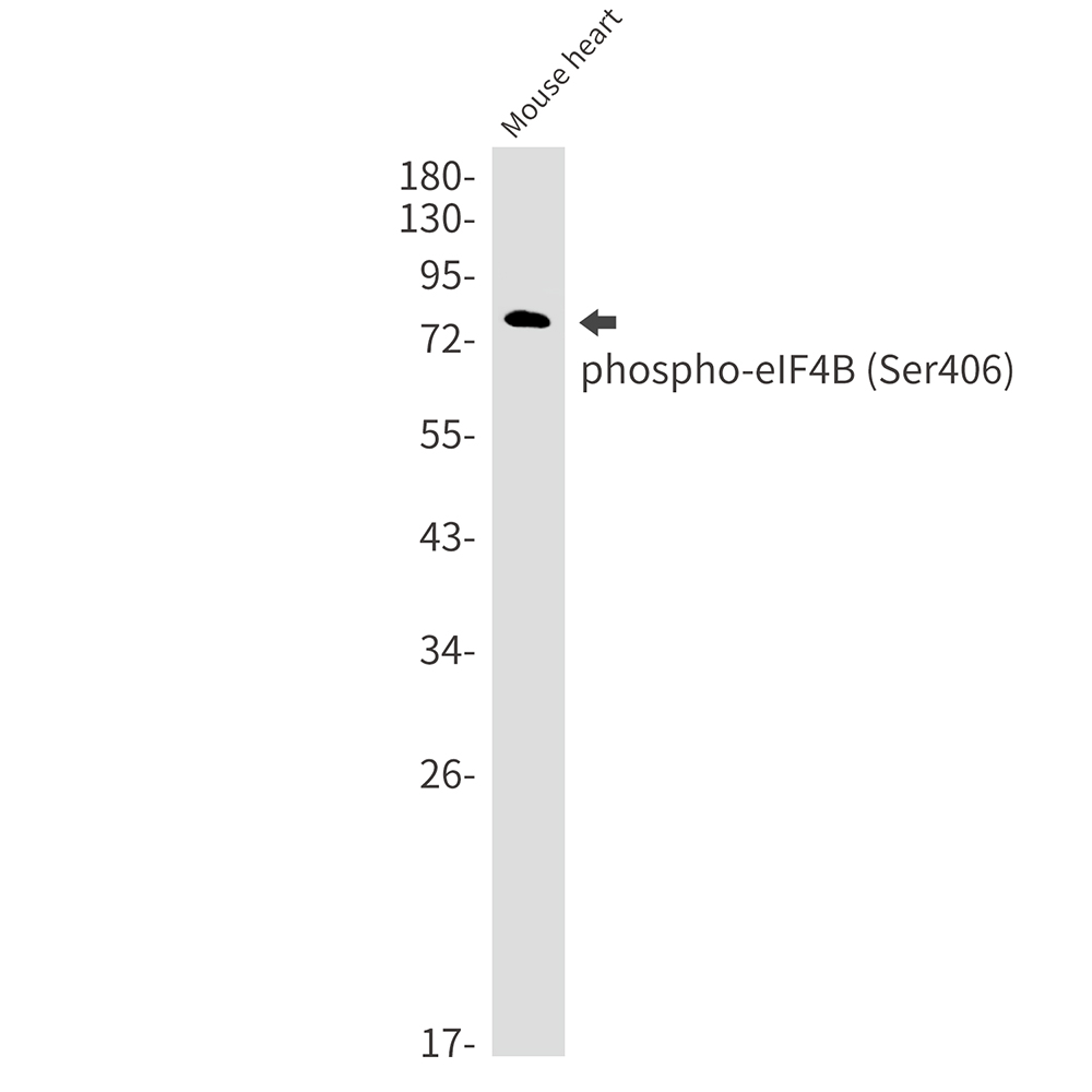 Phospho-eIF4B (Ser406)