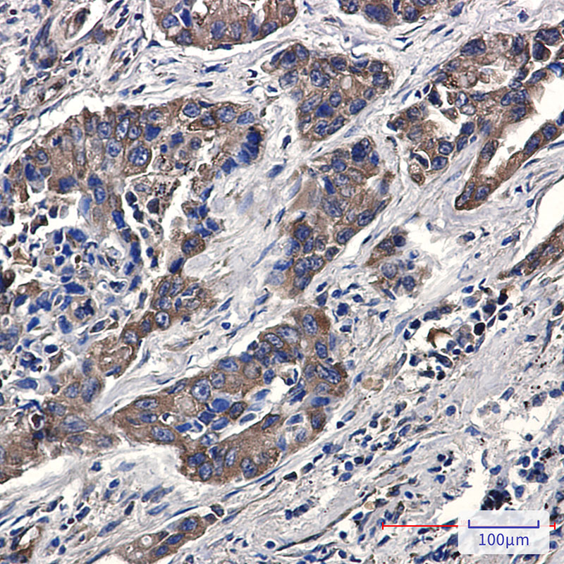 Rabbit Monoclonal Antibody to Phospho-eIF4B (Ser406)