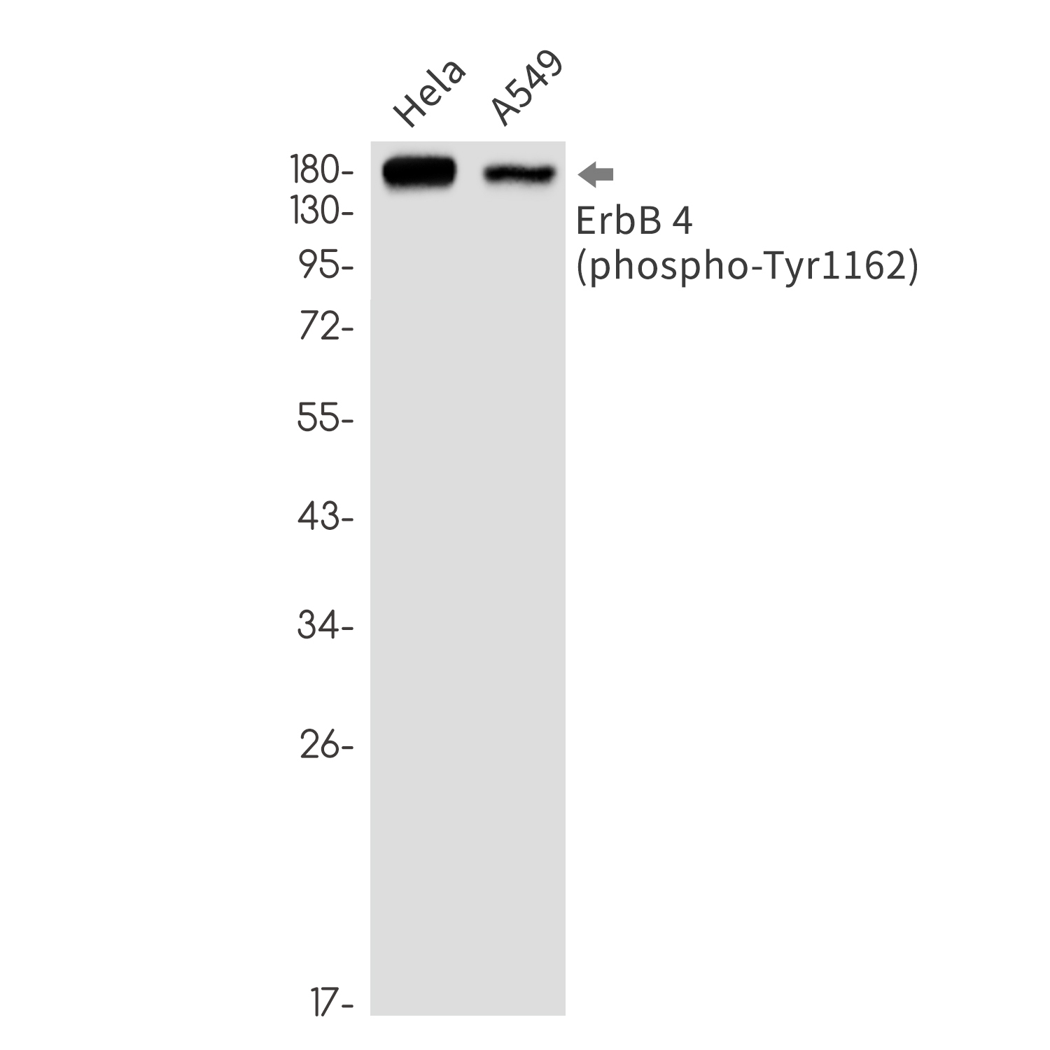 Phospho-ErbB 4 (Tyr1162)
