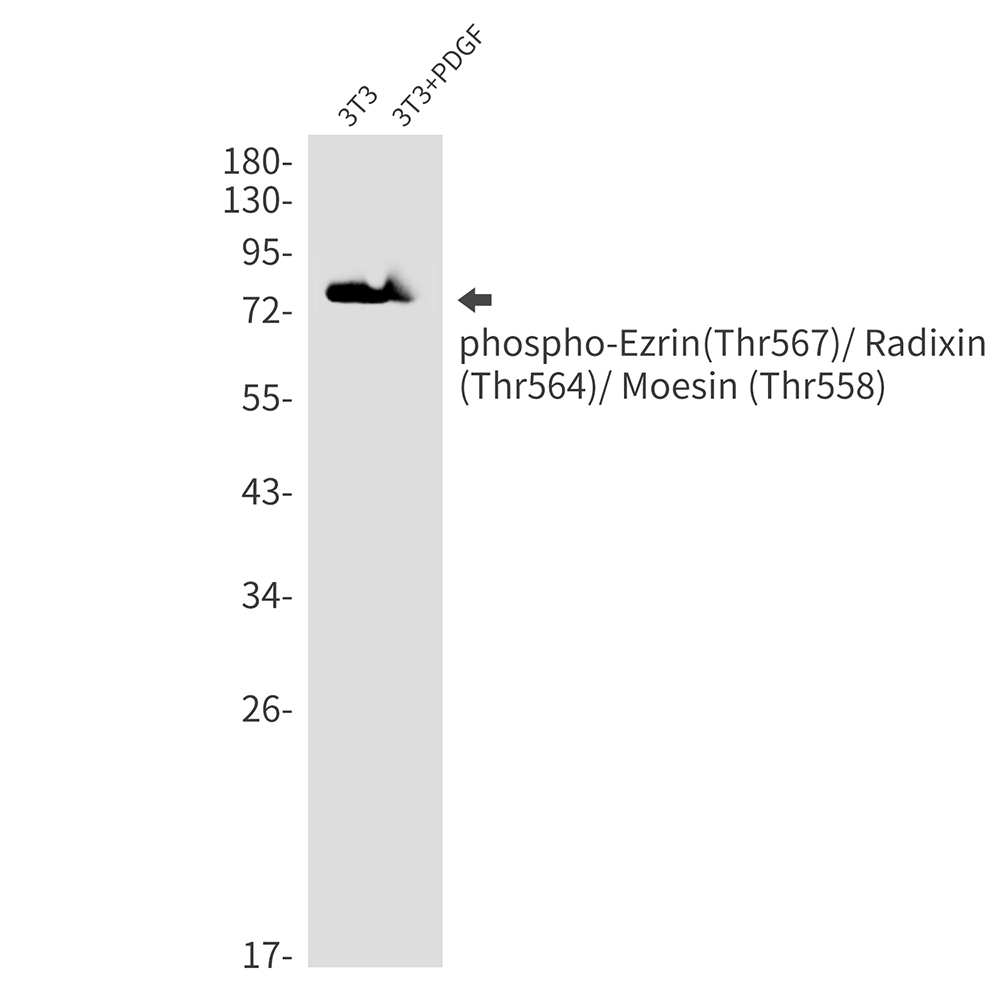 Phospho-Ezrin/Radixin/Moesin (Thr567/Thr564/Thr558)