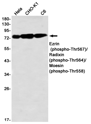 Rabbit Monoclonal Antibody to Phospho-Ezrin/Radixin/Moesin (Thr567/Thr564/Thr558)