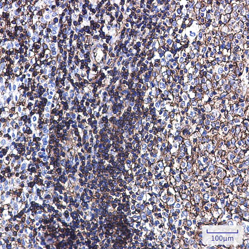 Rabbit Monoclonal Antibody to Phospho-Ezrin/Radixin/Moesin (Thr567/Thr564/Thr558)