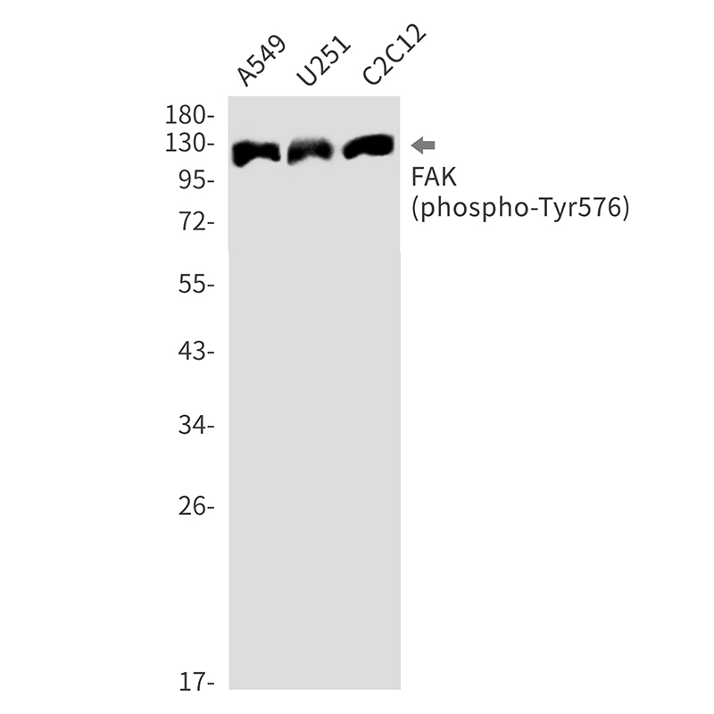 Phospho-FAK (Tyr576)
