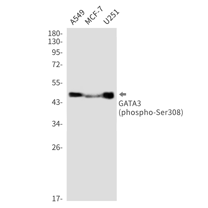 Phospho-GATA3 (Ser308)