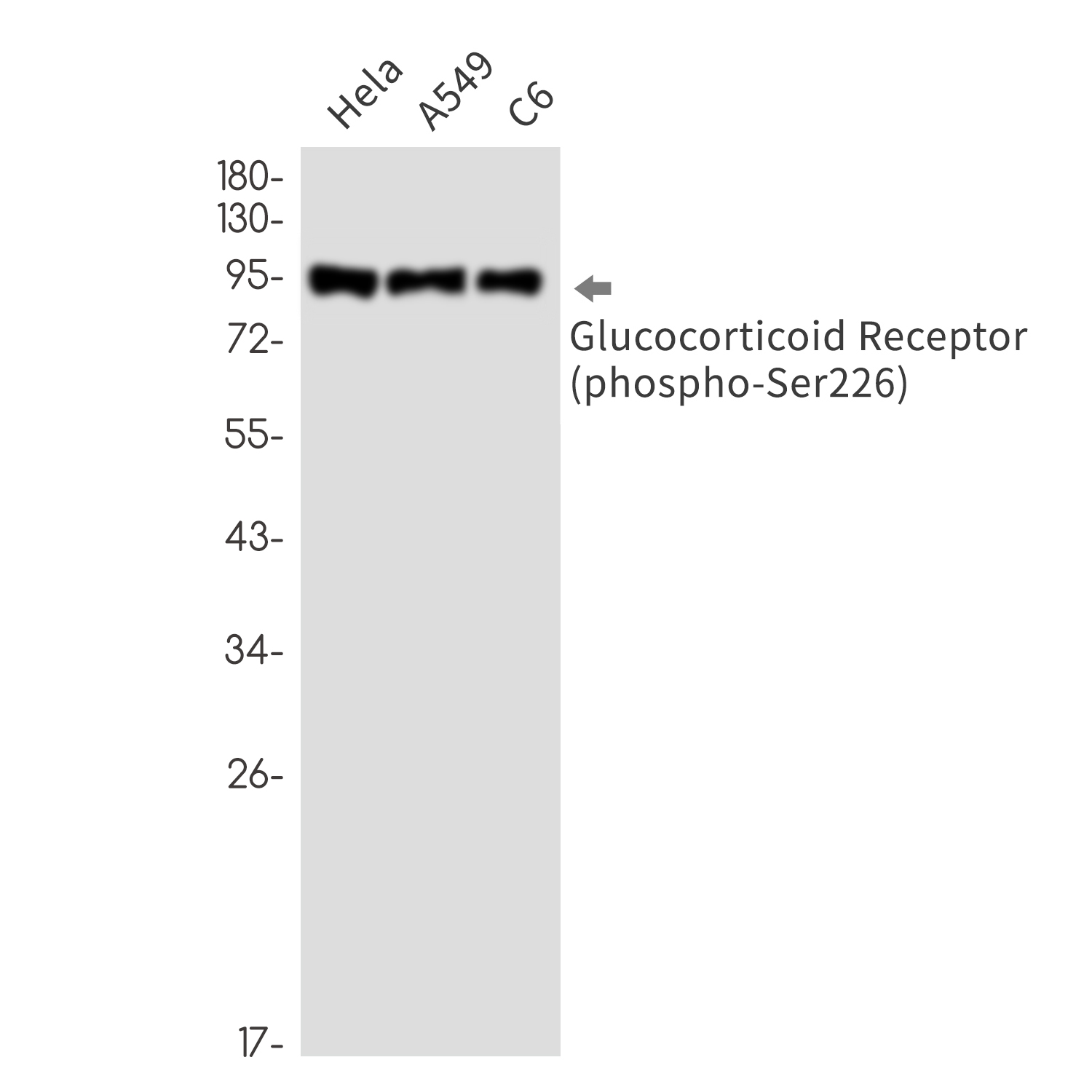 Phospho-Glucocorticoid Receptor (Ser226)