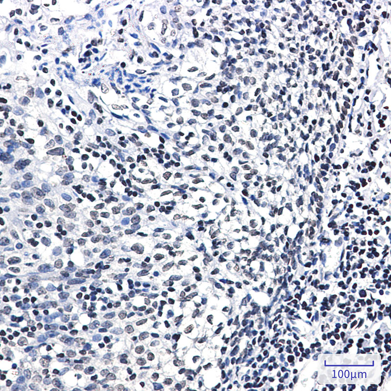 Rabbit Monoclonal Antibody to Phospho-Glucocorticoid Receptor (Ser226)