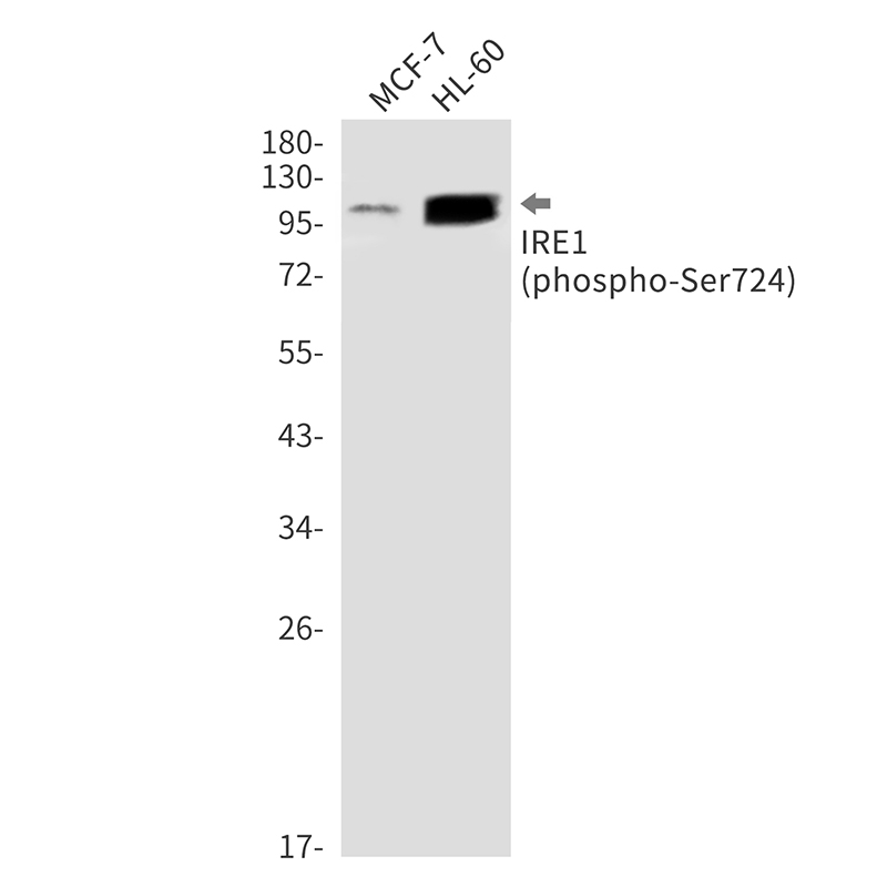 Phospho-IRE1 (Ser724)