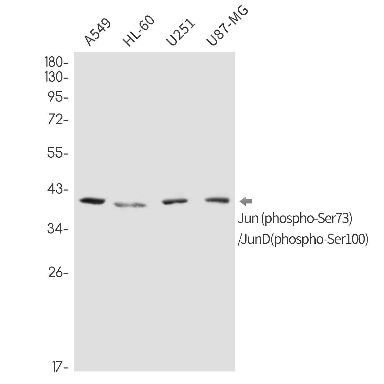 Phospho-Jun/JunD (Ser73/Ser100)