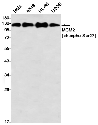Phospho-MCM2 (Ser27)