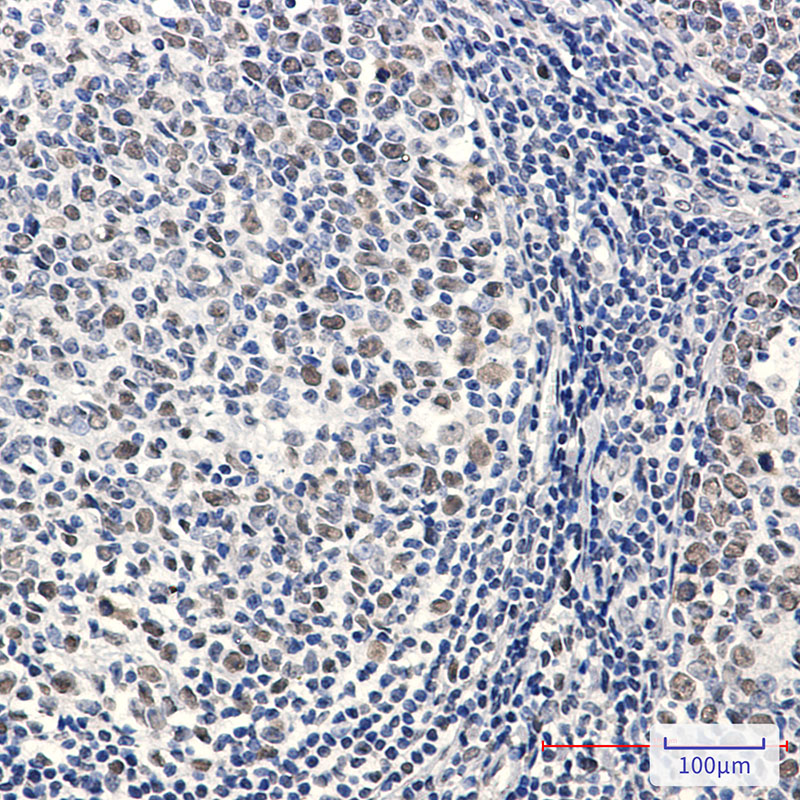 Rabbit Monoclonal Antibody to Phospho-MCM2 (Ser27)