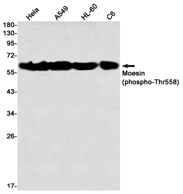 Phospho-Moesin (Thr558)