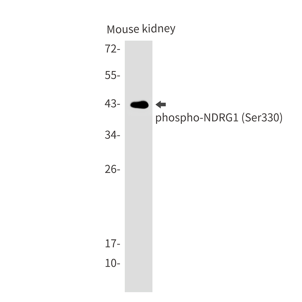 Phospho-NDRG1 (Ser330)