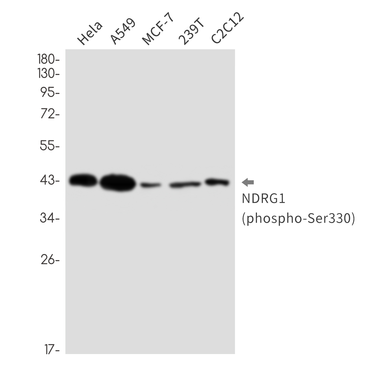 Rabbit Monoclonal Antibody to Phospho-NDRG1 (Ser330)