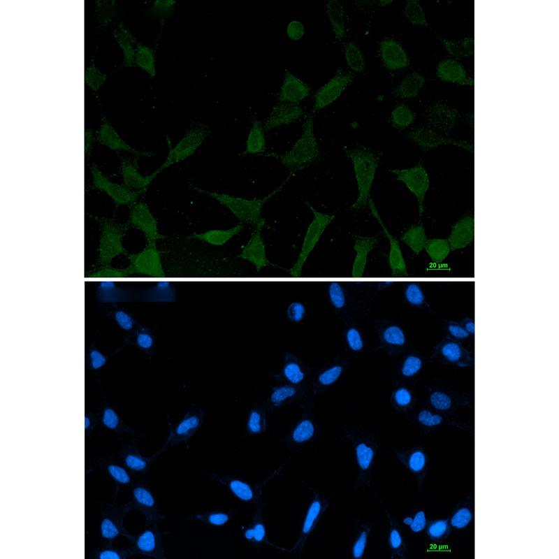 Rabbit Monoclonal Antibody to Phospho-NDRG1 (Ser330)