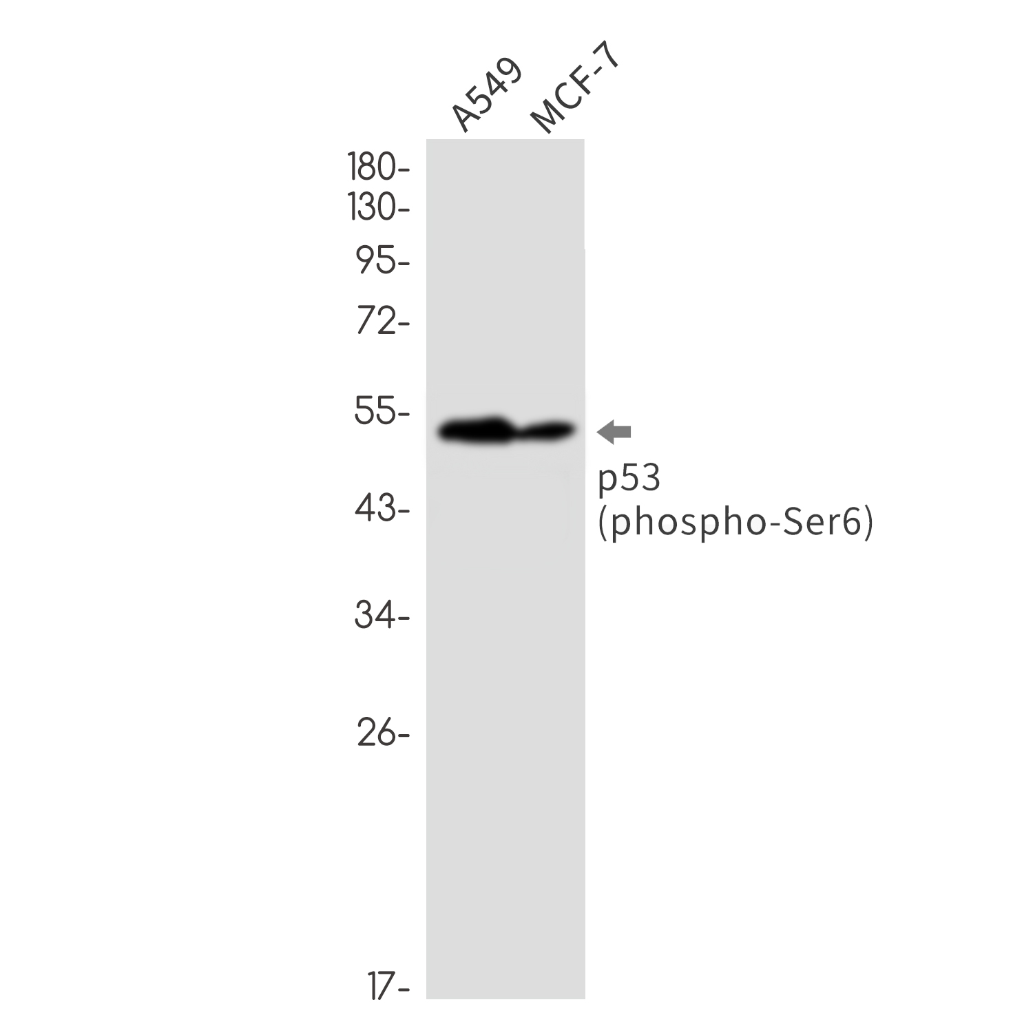 Phospho-p53 (Ser6)