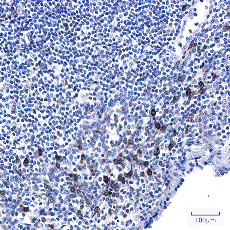 Rabbit Monoclonal Antibody to Phospho-p53 (Ser6)