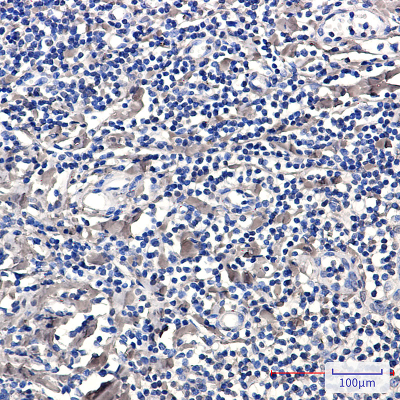 Rabbit Monoclonal Antibody to Phospho-PKC delta (Ser299)