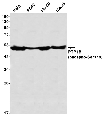 Phospho-PTP1B (Ser378)