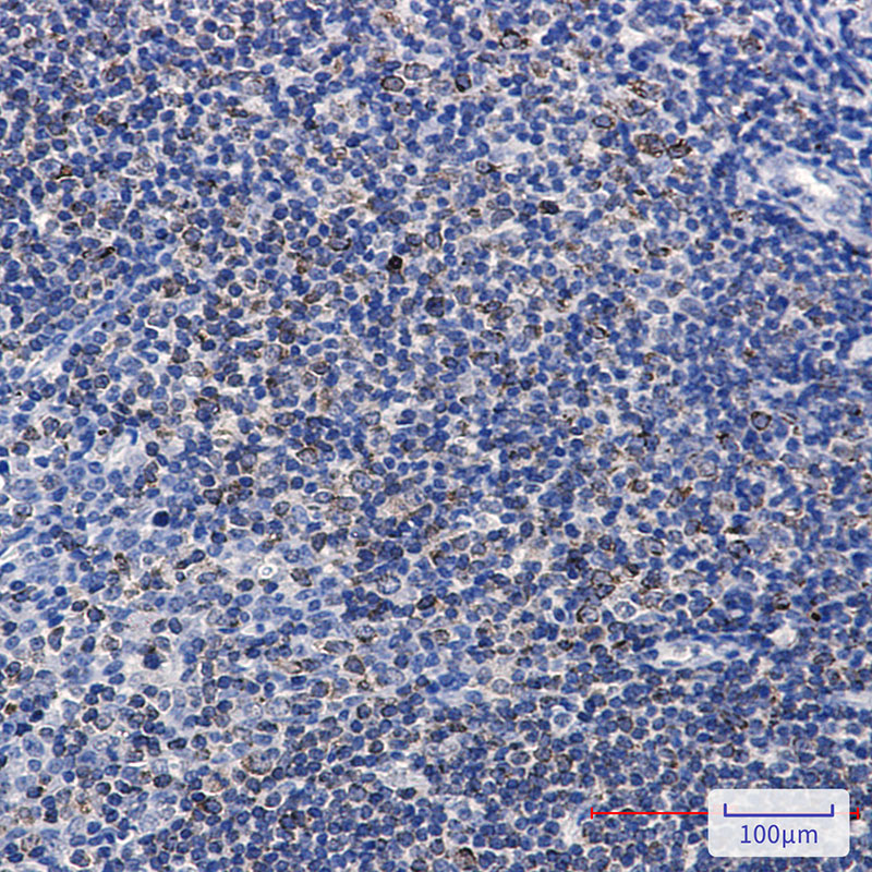 Rabbit Monoclonal Antibody to Phospho-PTP1B (Ser378)