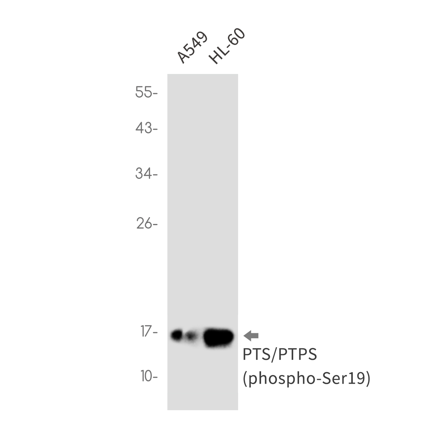 Phospho-PTS (Ser19)