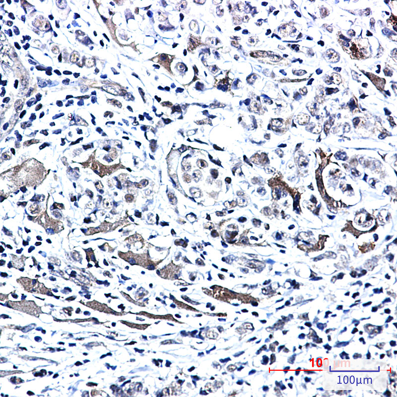 Rabbit Monoclonal Antibody to Phospho-PTS (Ser19)
