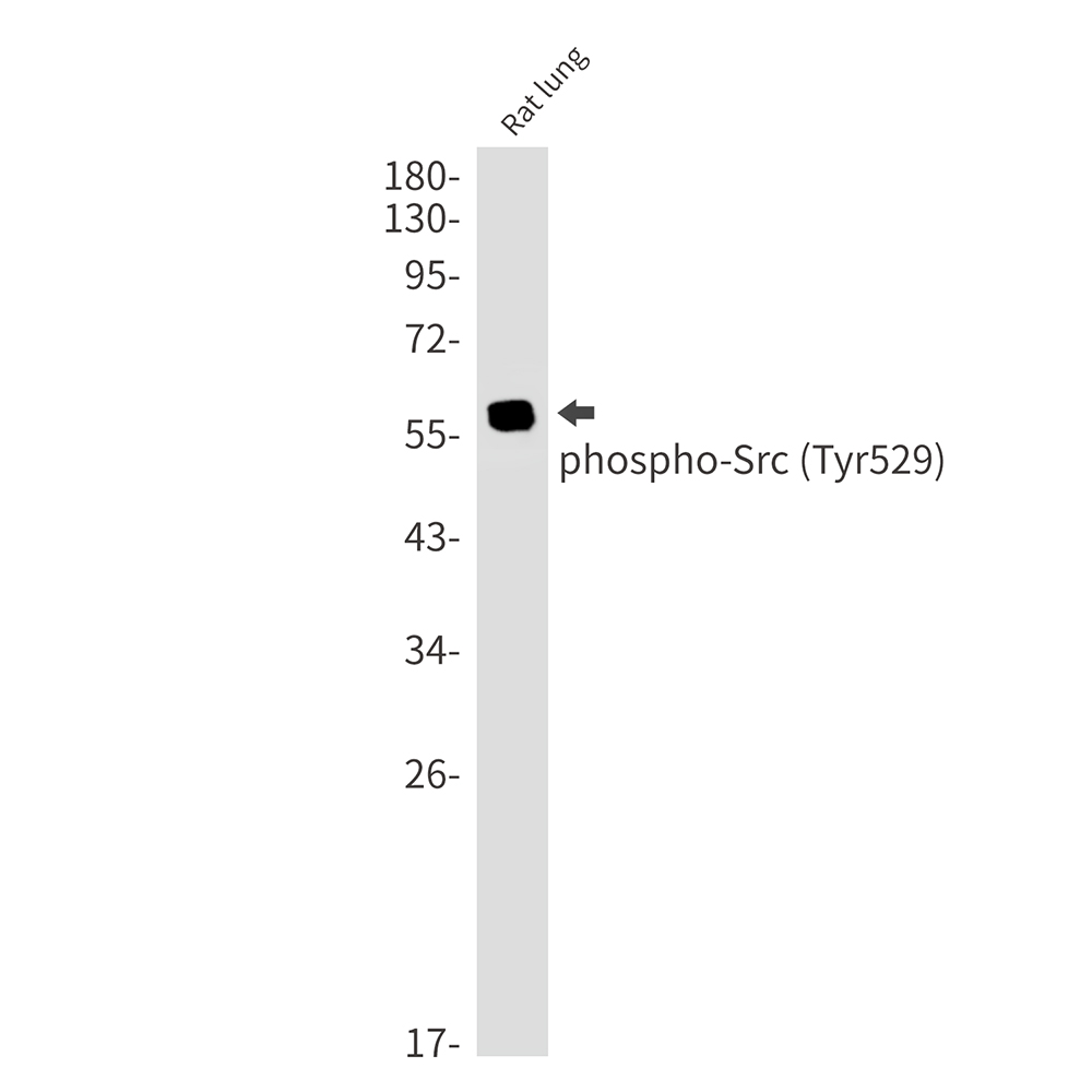 Phospho-Src (Tyr530)