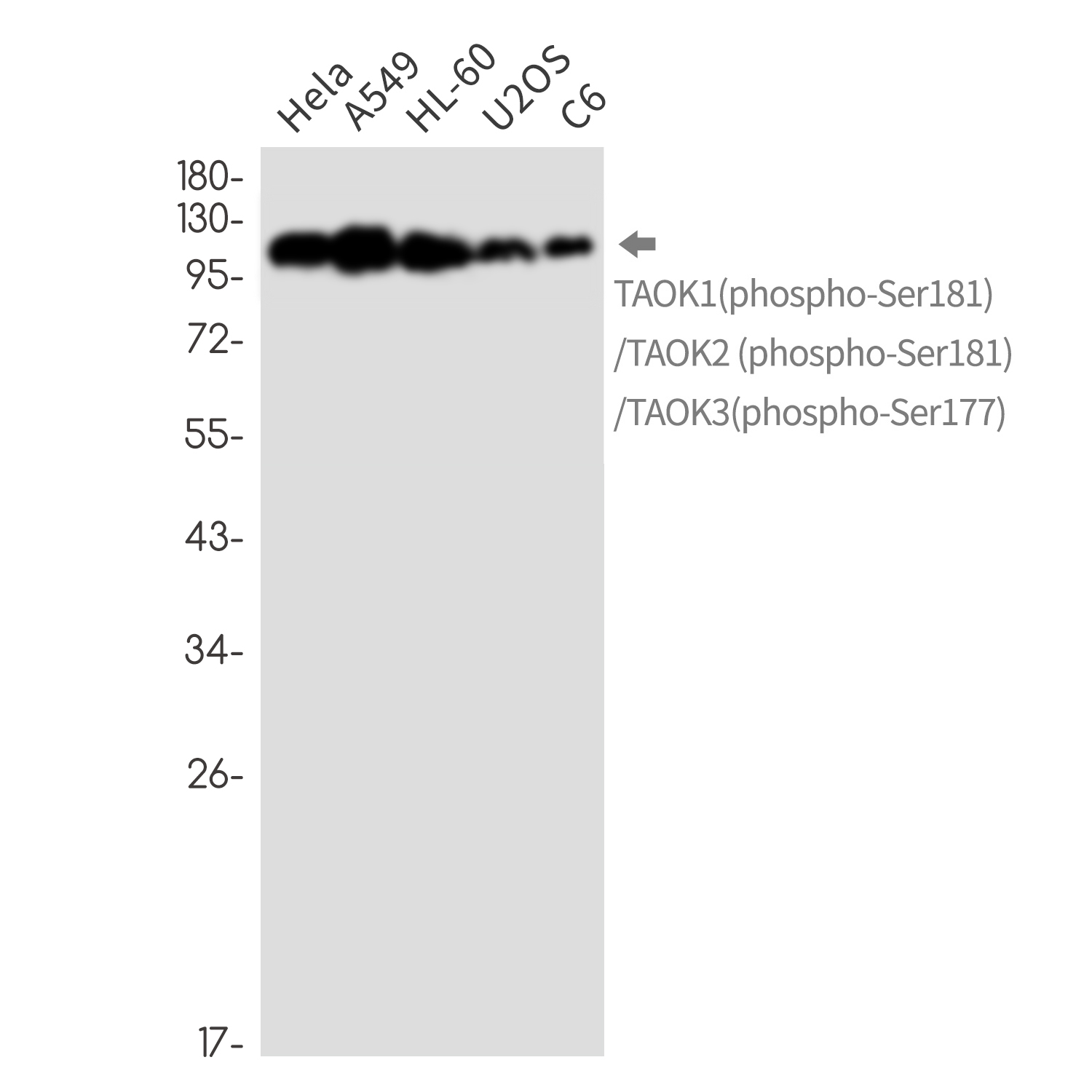 Rabbit Monoclonal Antibody to Phospho-TAOK1/2/3 (Ser181/Ser181/Ser177)