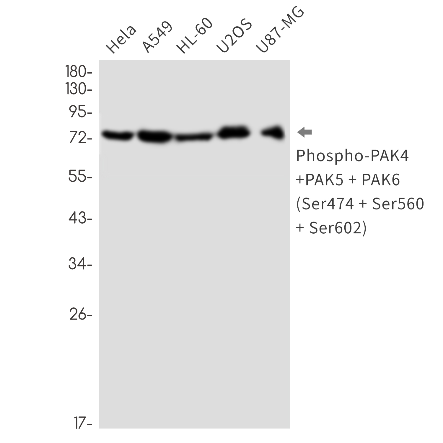 Phospho-PAK4/5/6 (Ser474/Ser560/Ser602)