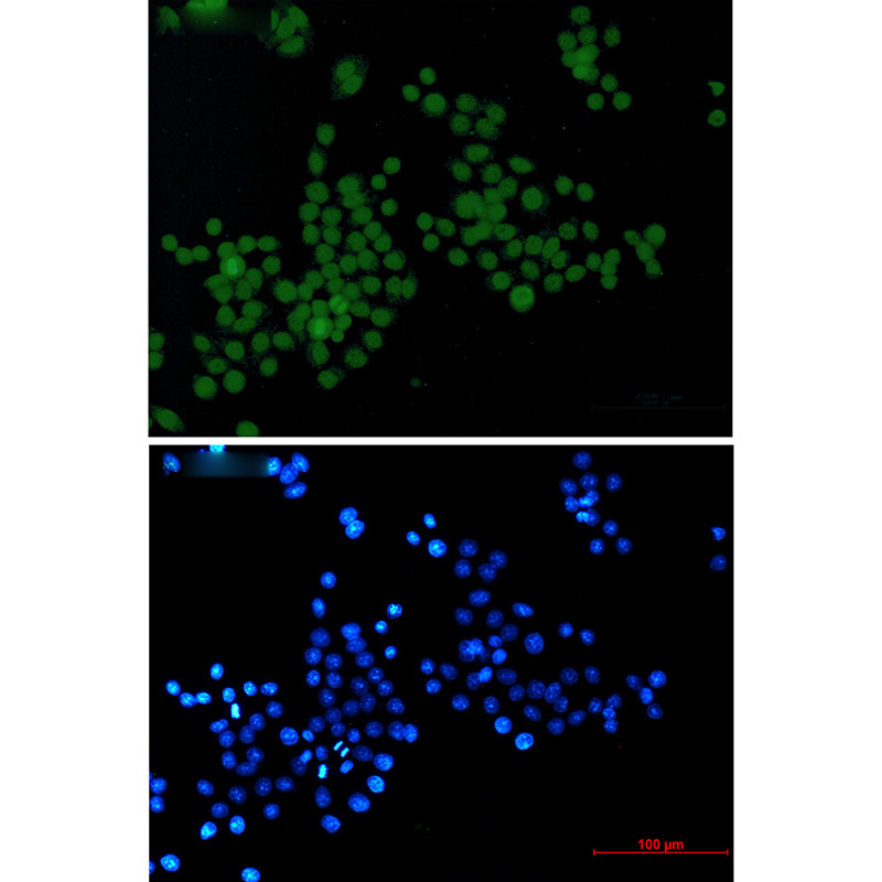 Rabbit Monoclonal Antibody to Phospho-Histone H3 (Ser10/Thr11)