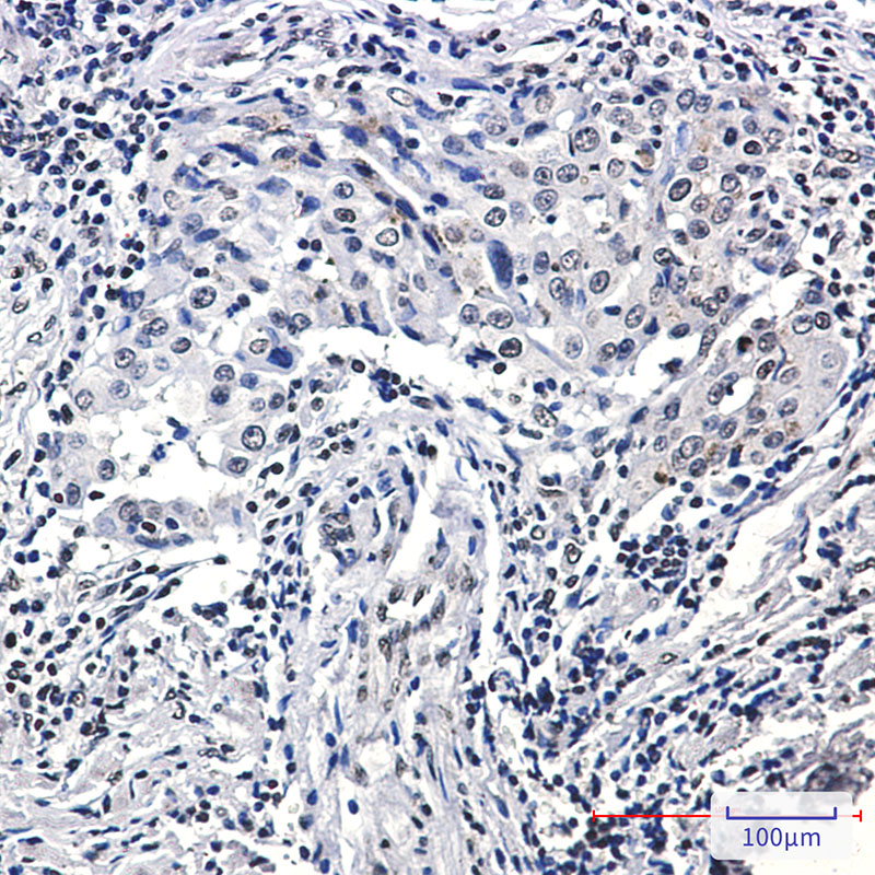Rabbit Monoclonal Antibody to Phospho-Histone H3 (Ser10/Thr11)