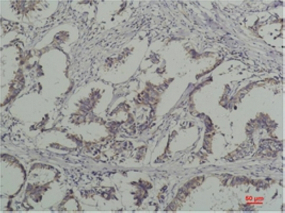 Mouse Monoclonal Antibody to Phospho-Tyrosine