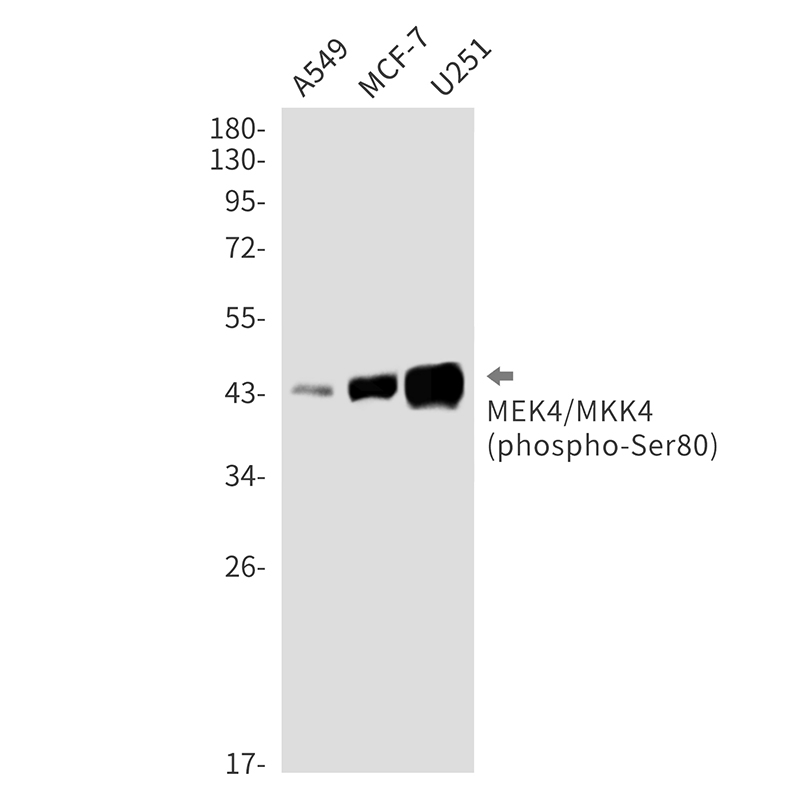 Rabbit Monoclonal Antibody to Phospho-MEK4 (Ser80)
