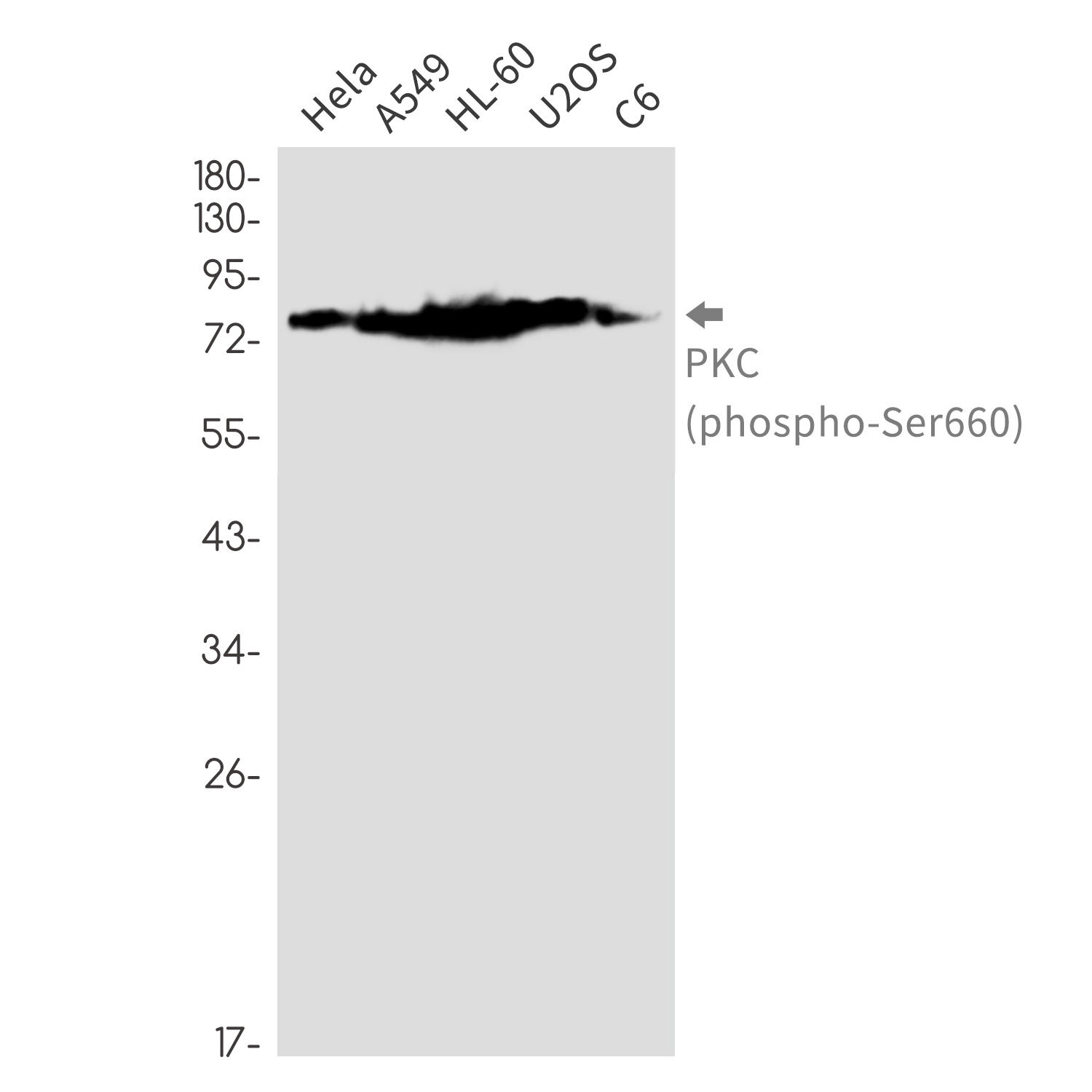 Phospho-PKC (Ser660)