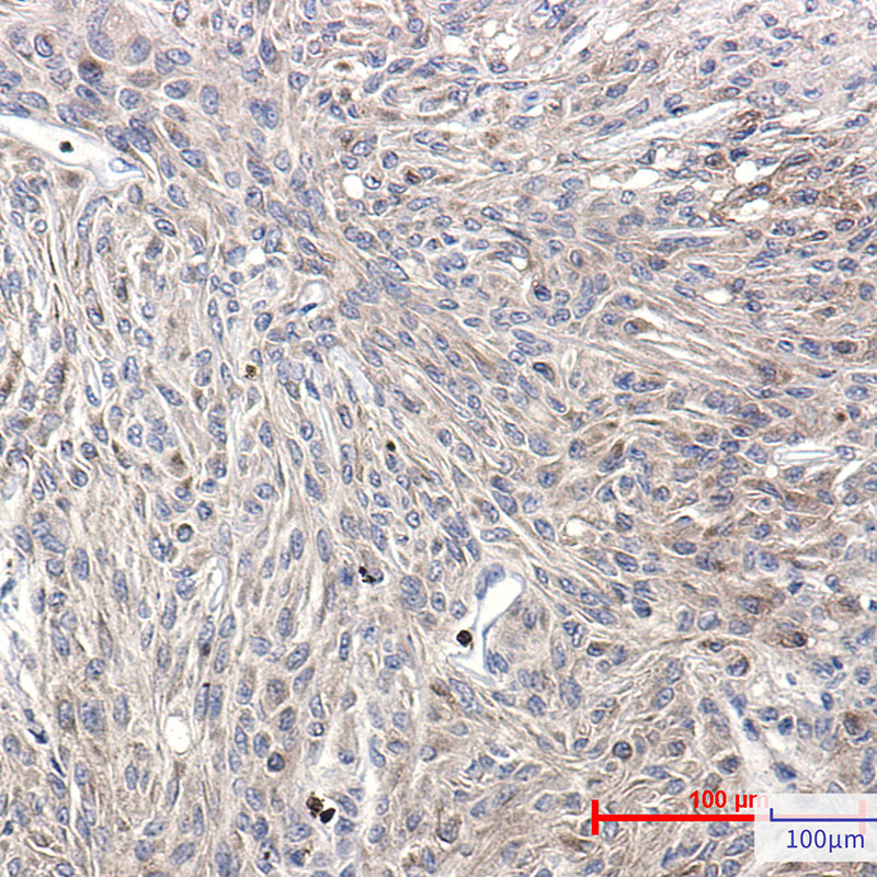 Rabbit Monoclonal Antibody to Phospho-PKC (Ser660)