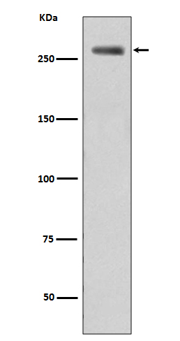 Phospho-LRRK2 (Ser395)