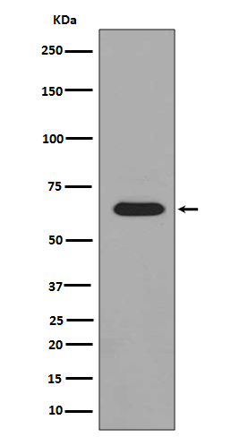 Phospho-PAK1/2/3 (Ser144/Ser141/Ser154)