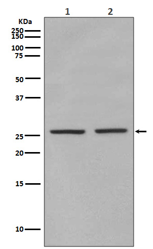 Phospho-eIF4E (Ser209)