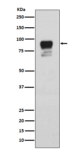 Phospho-Glycogen Synthase (Ser641)